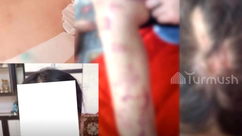 «Телесные повреждения пиалой»: В Токмоке проводится проверка о семейном насилии мужчины в отношении своей супруги